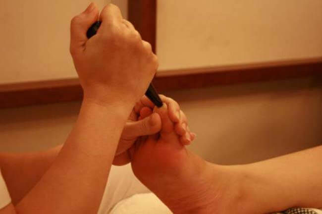 CÂY ẤN HUYỆT