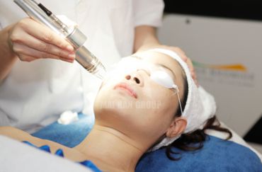 Xóa xăm hiệu quả ngay từ lần đầu tiên cùng công nghệ xóa xăm Picosecond