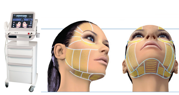 Trẻ hóa da với công nghệ Hifu