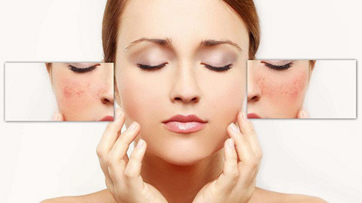 Hình ảnh trước và sau khi điều trị