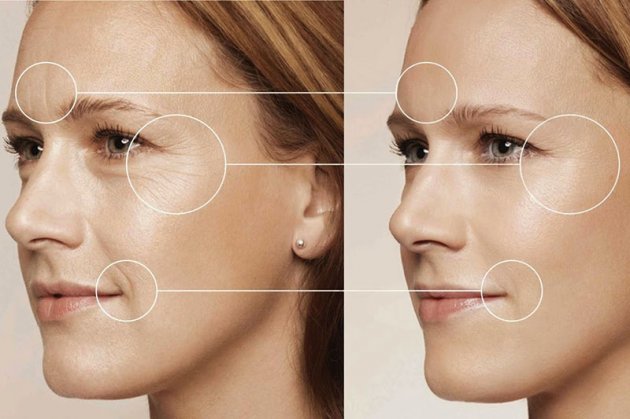 Hình ảnh trước và sau khi điều trị