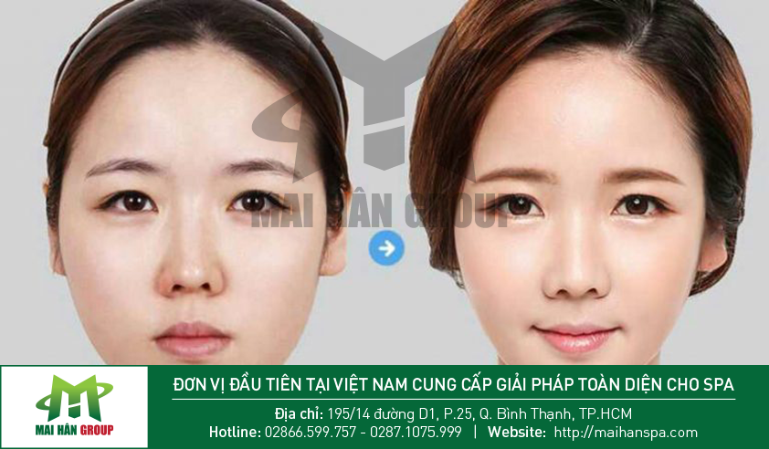 Hình ảnh trước và sau khi sử dụng liệu trình