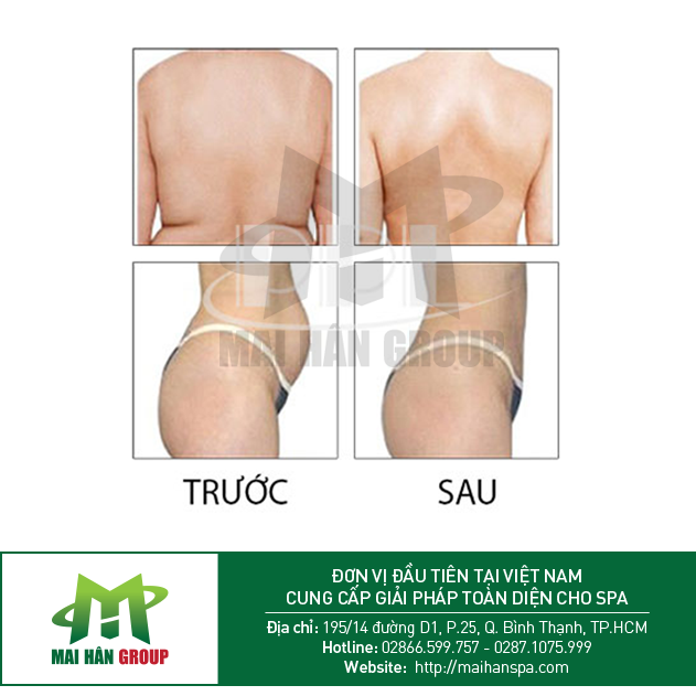 Hình ảnh trước và sau khi điều trị Hình ảnh trước và sau khi điều trị