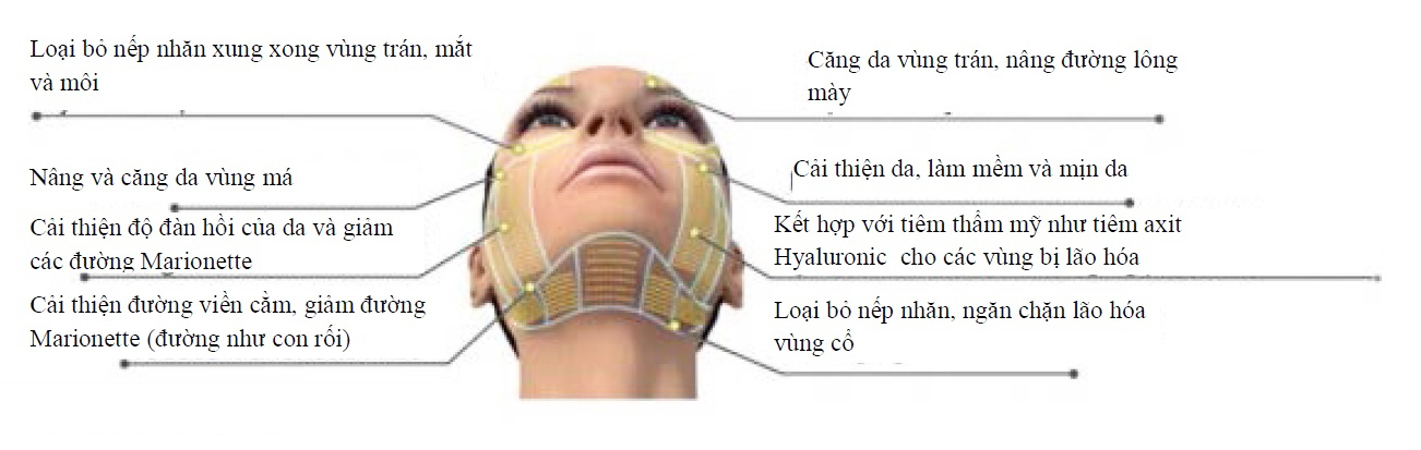 Máy Nâng Cơ, Xóa Nhăn Không Phẫu Thuật Hifu Ultherapy - Giá Tốt Máy Nâng Cơ, Xóa Nhăn Không Phẫu Thuật Hifu Ultherapy - Giá Tốt