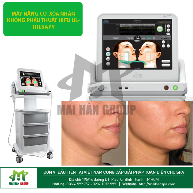 Máy Nâng Cơ, Xóa Nhăn Không Phẫu Thuật Hifu Ultherapy - Giá Tốt Máy Nâng Cơ, Xóa Nhăn Không Phẫu Thuật Hifu Ultherapy - Giá Tốt