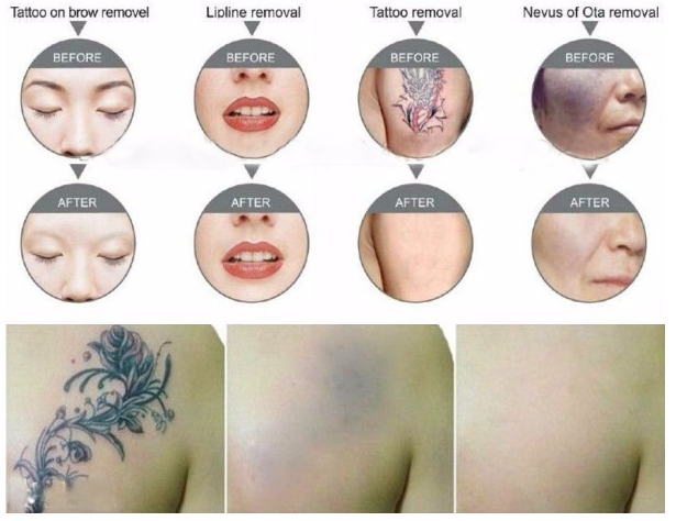 Một số hình ảnh trước và sau quá trình điều trị Một số hình ảnh trước và sau quá trình điều trị