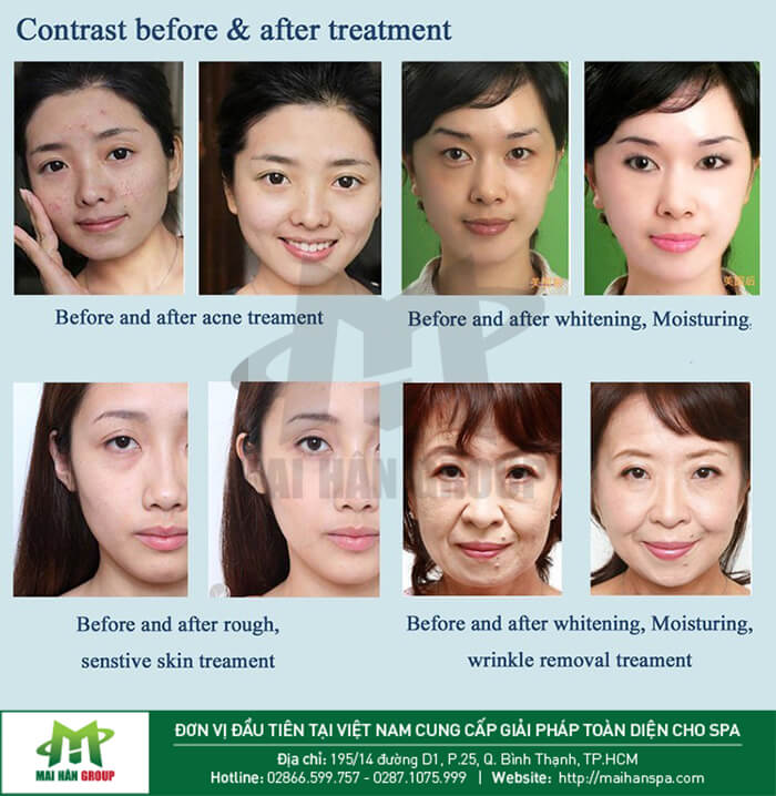 7 ưu điểm của máy cung cấp oxy đa chức năng KES-400 7 ưu điểm của máy cung cấp oxy đa chức năng KES-400