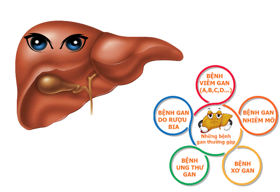 Những bệnh về gan phổ biến hiện nay thường mắc phải Những bệnh về gan phổ biến hiện nay thường mắc phải