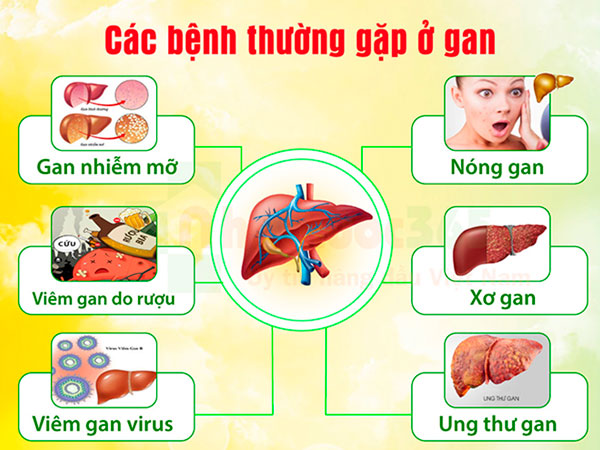 Các bệnh về gan hiện nay