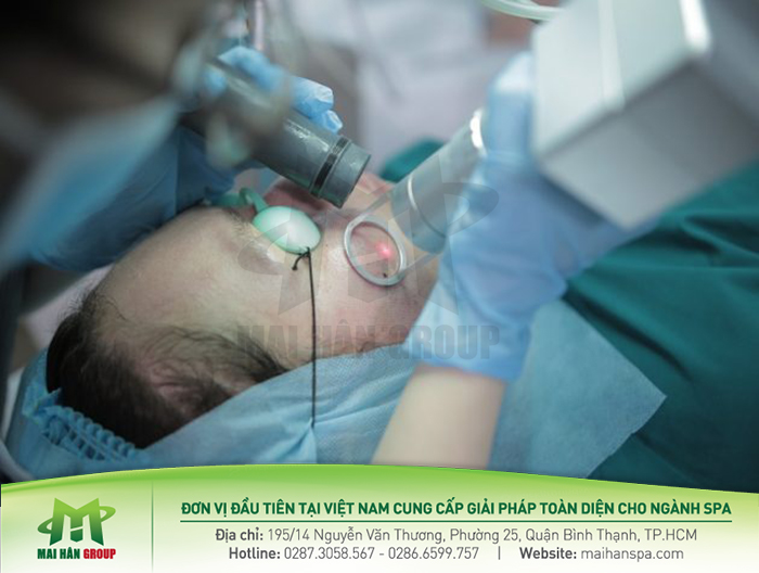 Liệu trình điều trị bằng Laser CO2 Fractional Coscan II không quá dài Liệu trình điều trị bằng Laser CO2 Fractional Coscan II không quá dài