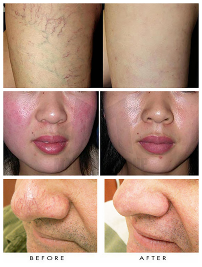 Kết quả sau khi điều trị Kết quả sau khi điều trị