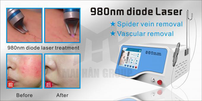Thiết bị sử dụng công nghệ laser bán dẫn Thiết bị sử dụng công nghệ laser bán dẫn