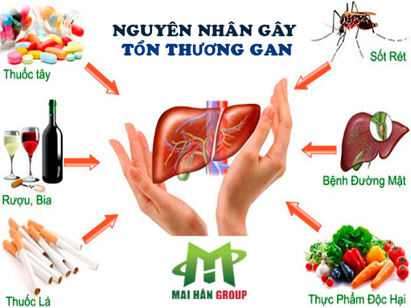 Nguyên nhân gây tổn thương gan