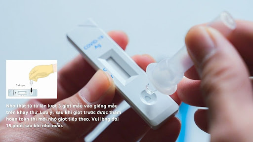 Kiểm tra mẫu bệnh phẩm