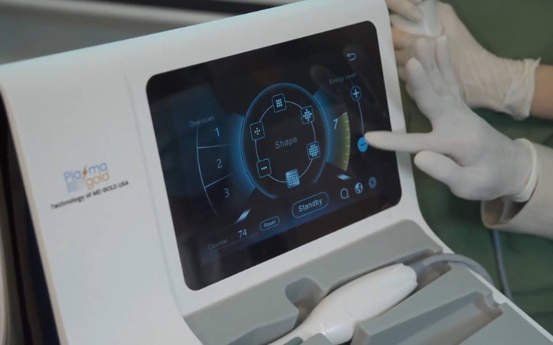 Các chế độ sử dụng của Plasma Gold