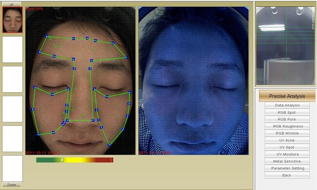 Công nghệ soi da cắt lớp – Tiền đề vô cùng quan trọng để chăm sóc làn da khỏe đẹp hình ảnh 4