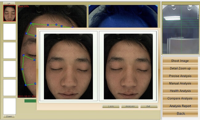 Công nghệ soi da cắt lớp – Tiền đề vô cùng quan trọng để chăm sóc làn da khỏe đẹp hình ảnh 6