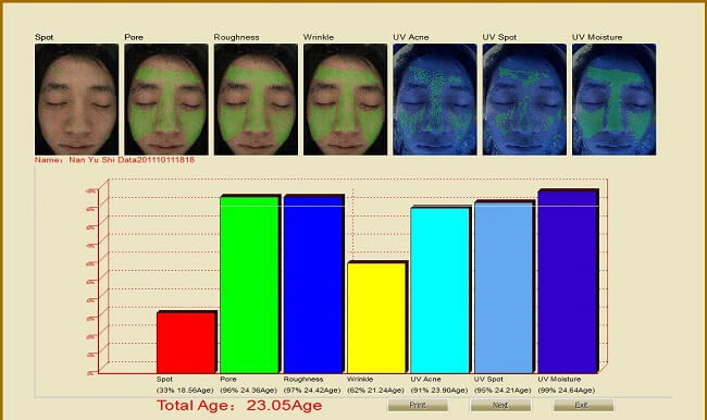 Công nghệ soi da cắt lớp – Tiền đề vô cùng quan trọng để chăm sóc làn da khỏe đẹp hình ảnh 7